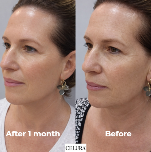 Collagen Mask | 5 pc