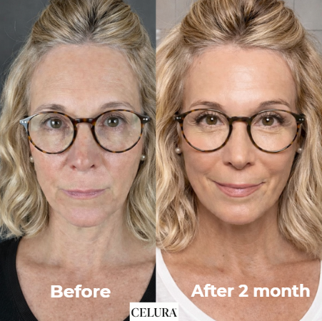 Collagen Mask | 5 pc