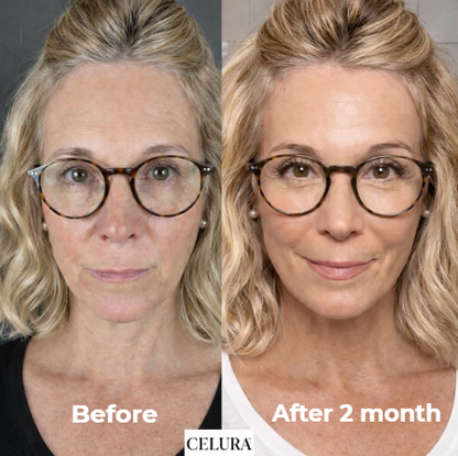 Collagen Mask | 5 pc